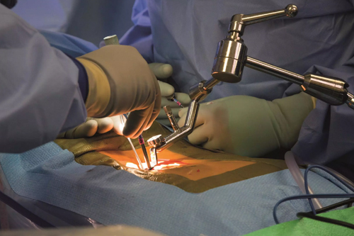 Spine Surgery