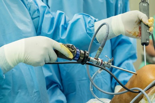 Shoulder Surgery