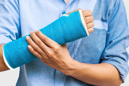Fracture Management