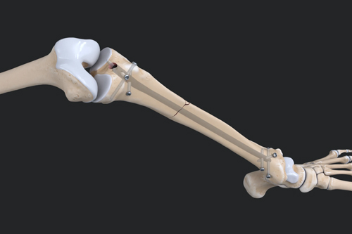 Trauma Surgery