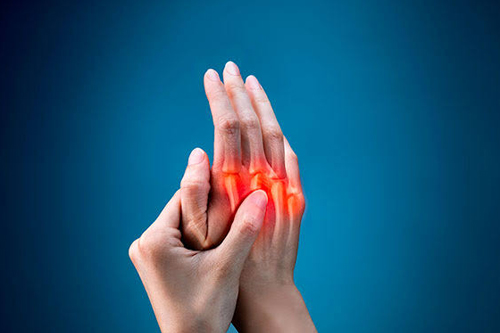 Arthritis