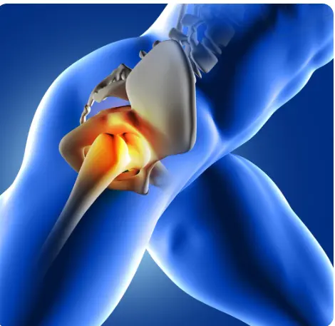 Best Hip Replacement Surgeon in Goregaon