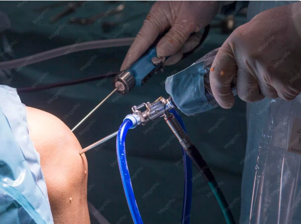 Best Knee Replacement Surgeon in Borivali